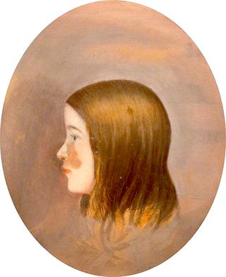 Portrait of a Girl with a Birth Mark